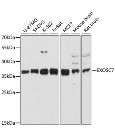 EXOSC7 Rabbit Polyclonal Antibody