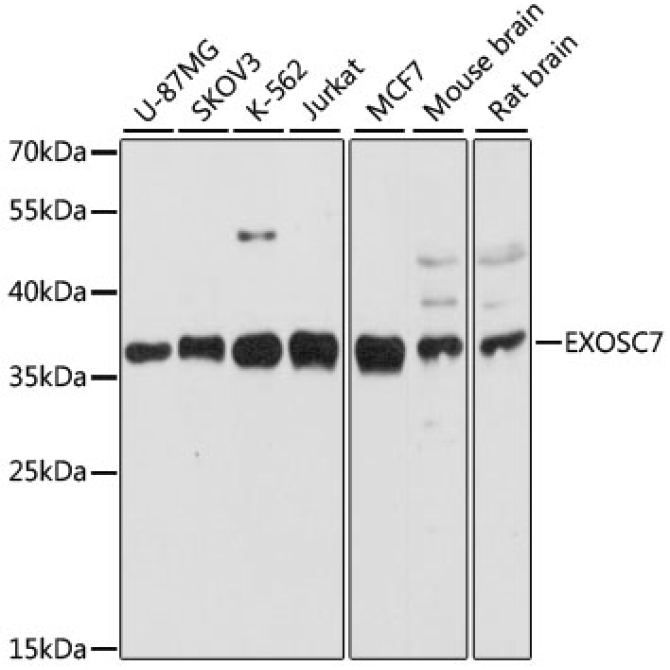 EXOSC7 Rabbit Polyclonal Antibody