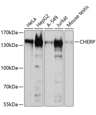 CHERP Rabbit Polyclonal Antibody