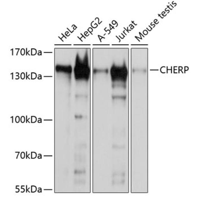 CHERP Rabbit Polyclonal Antibody