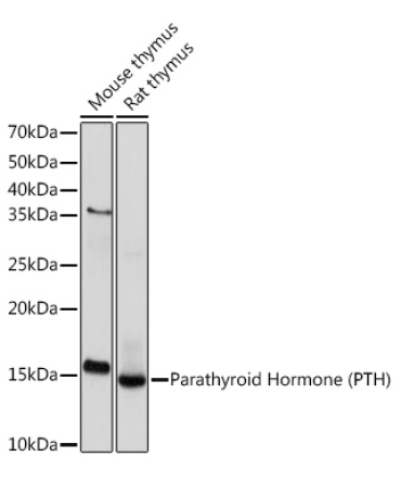 Parathyroid Hormone (PTH) Rabbit Monoclonal Antibody