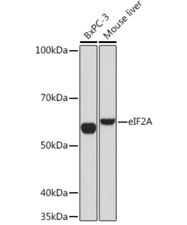 eIF2A Rabbit Monoclonal Antibody