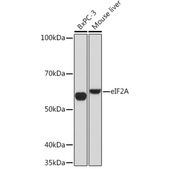 eIF2A Rabbit Monoclonal Antibody