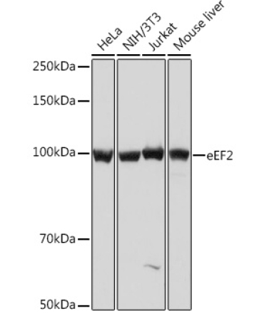 eEF2 Rabbit Monoclonal Antibody