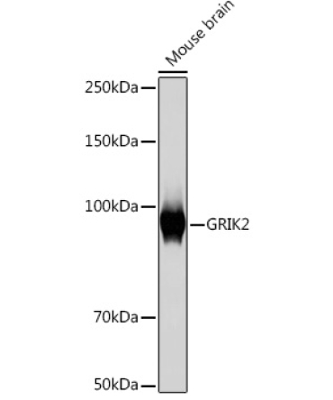 GRIK2 Rabbit Monoclonal Antibody