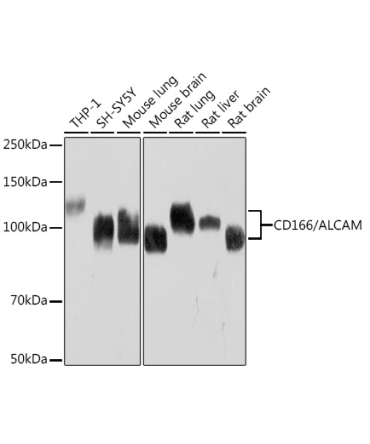 CD166/ALCAM Rabbit Monoclonal Antibody