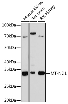 MT-ND1 Rabbit Monoclonal Antibody
