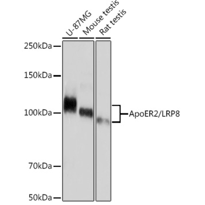 ApoER2/LRP8 Rabbit Monoclonal Antibody