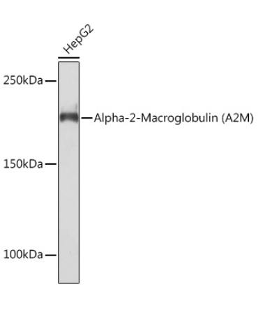 Alpha-2-Macroglobulin (A2M) Rabbit Monoclonal Antibody