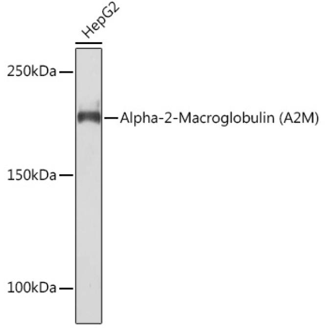 Alpha-2-Macroglobulin (A2M) Rabbit Monoclonal Antibody