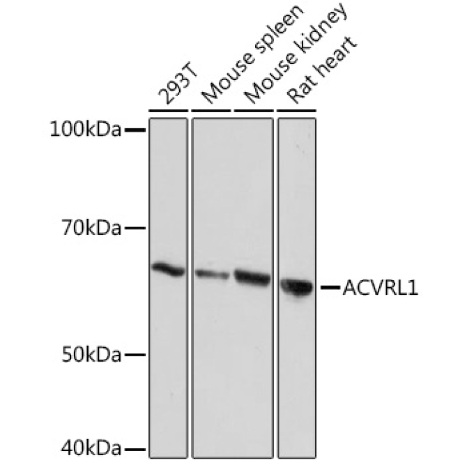 ACVRL1 Rabbit Monoclonal Antibody