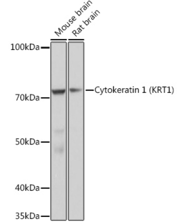 Cytokeratin 1 (KRT1) Rabbit Monoclonal Antibody