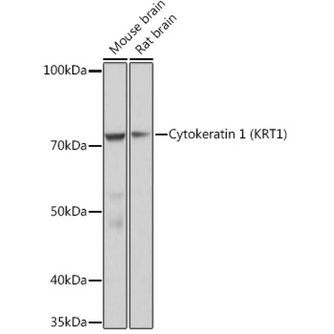 Cytokeratin 1 (KRT1) Rabbit Monoclonal Antibody