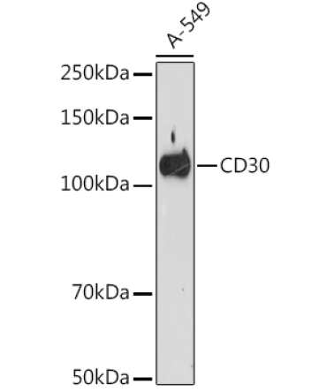 CD30 Rabbit Monoclonal Antibody