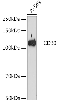 CD30 Rabbit Monoclonal Antibody