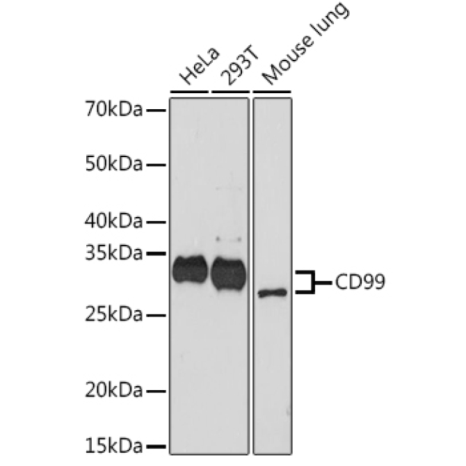 CD99 Rabbit Monoclonal Antibody