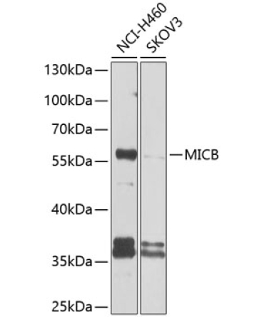 MICB Rabbit Polyclonal Antibody
