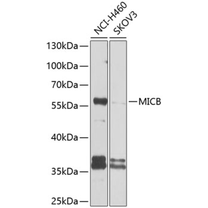 MICB Rabbit Polyclonal Antibody