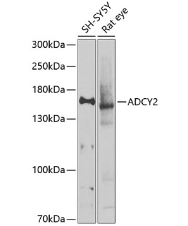 ADCY2 Rabbit Polyclonal Antibody