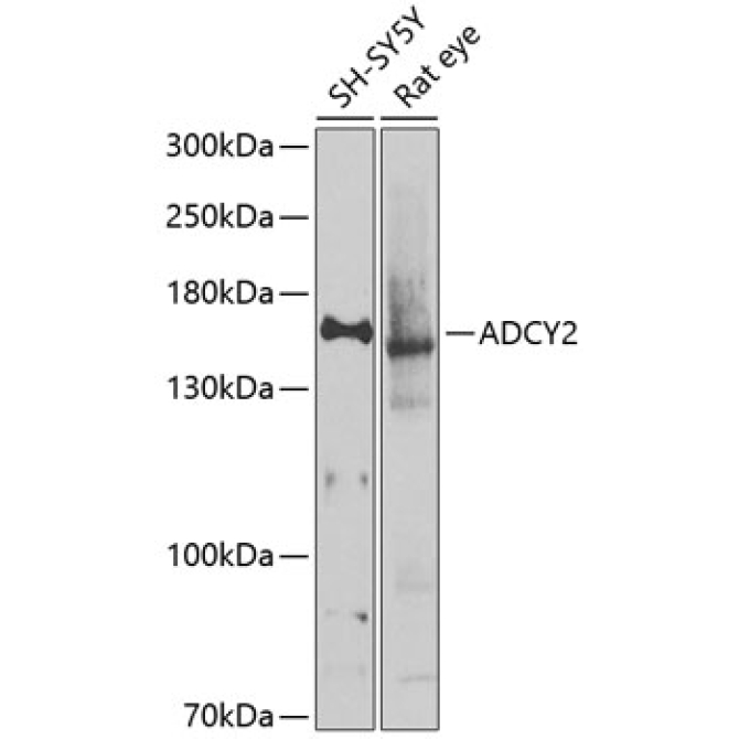 ADCY2 Rabbit Polyclonal Antibody