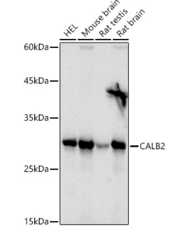 Calretinin Rabbit Polyclonal Antibody