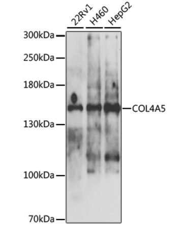 COL4A5 Rabbit Polyclonal Antibody