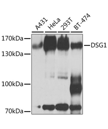 DSG1 Rabbit Polyclonal Antibody