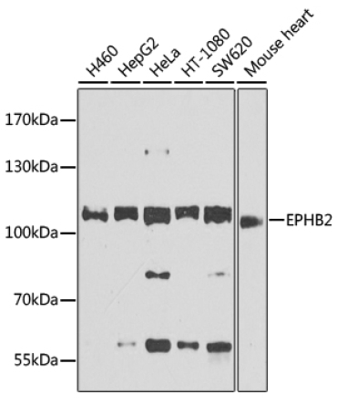 EPHB2 Rabbit Polyclonal Antibody