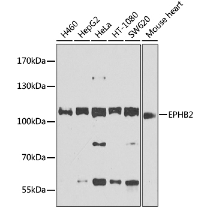 EPHB2 Rabbit Polyclonal Antibody
