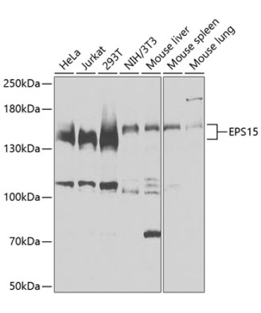EPS15 Rabbit Polyclonal Antibody