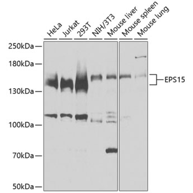 EPS15 Rabbit Polyclonal Antibody