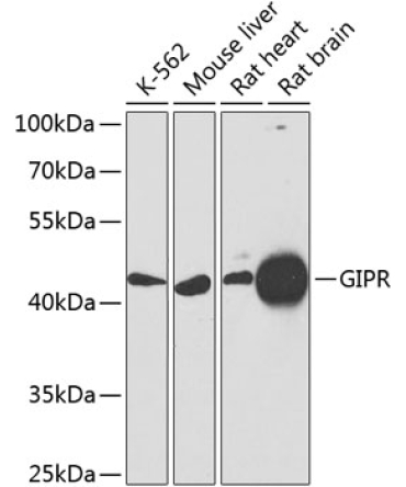 GIPR Rabbit Polyclonal Antibody