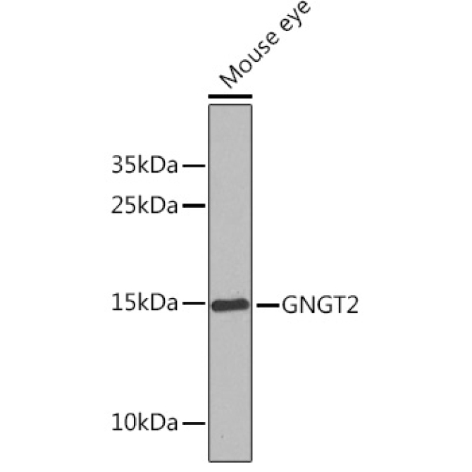 GNGT2 Rabbit Polyclonal Antibody