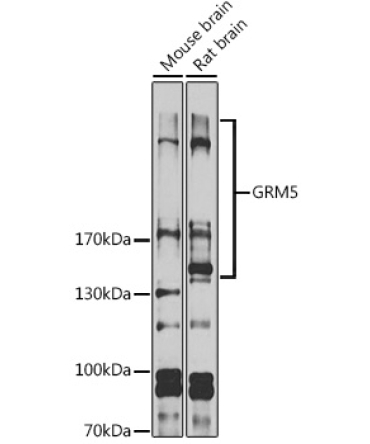 GRM5 Rabbit Polyclonal Antibody