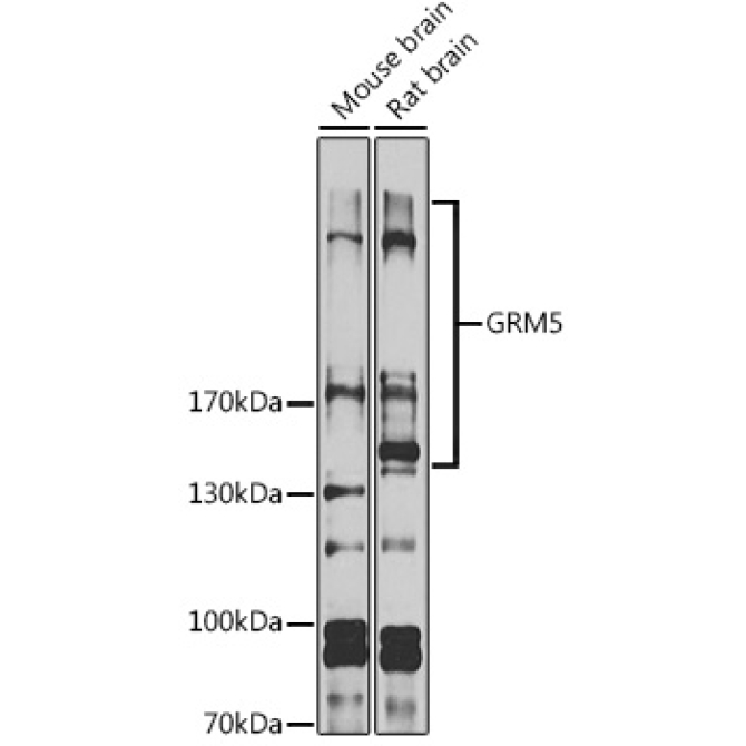 GRM5 Rabbit Polyclonal Antibody