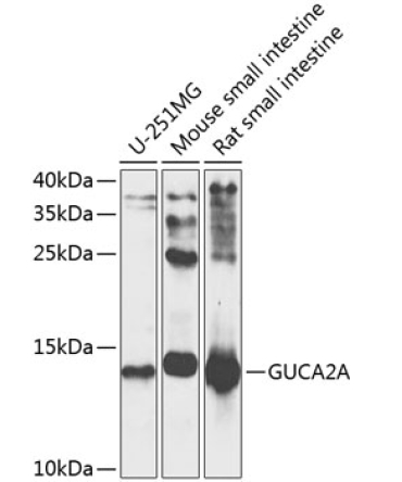 GUCA2A Rabbit Polyclonal Antibody
