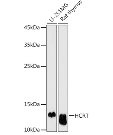 HCRT Rabbit Polyclonal Antibody