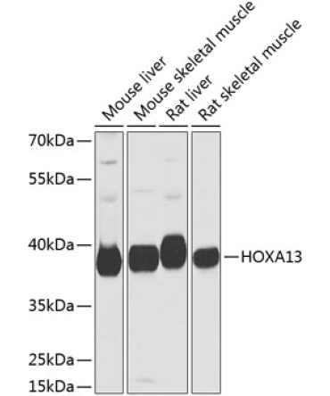 HOXA13 Rabbit Polyclonal Antibody