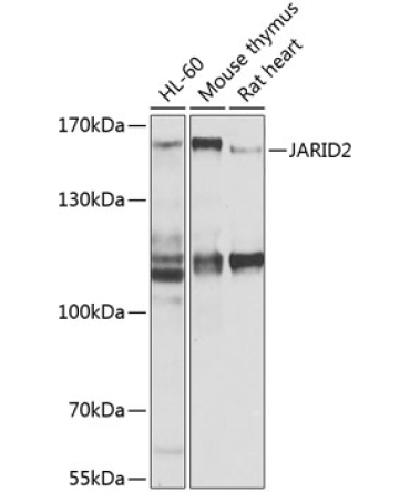 JARID2 Rabbit Polyclonal Antibody