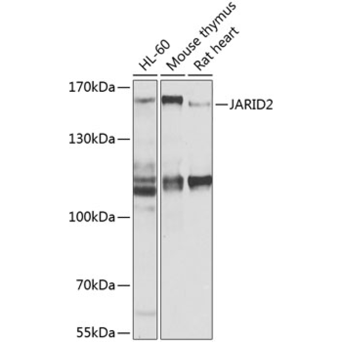 JARID2 Rabbit Polyclonal Antibody