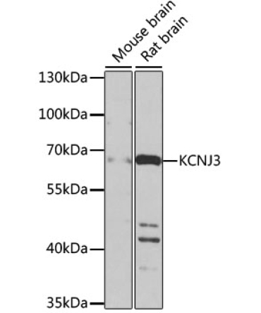 KCNJ3 Rabbit Polyclonal Antibody