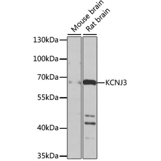 KCNJ3 Rabbit Polyclonal Antibody