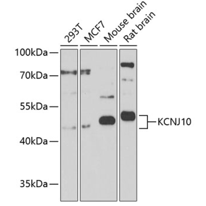KCNJ10 Rabbit Polyclonal Antibody