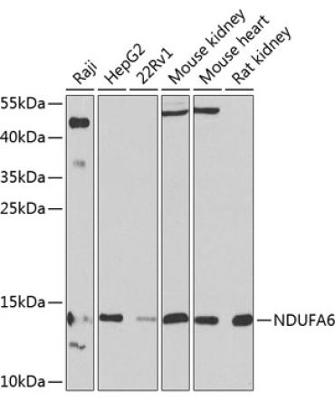 NDUFA6 Rabbit Polyclonal Antibody