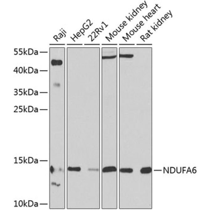 NDUFA6 Rabbit Polyclonal Antibody