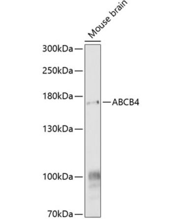 ABCB4 Rabbit Polyclonal Antibody