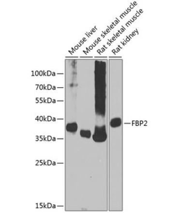 FBP2 Rabbit Polyclonal Antibody