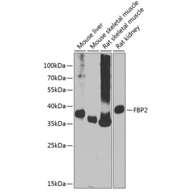 FBP2 Rabbit Polyclonal Antibody