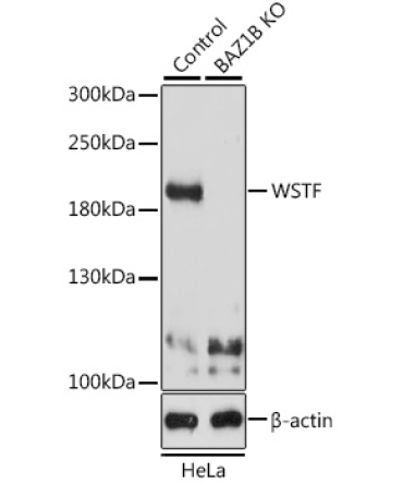 WSTF Rabbit Polyclonal Antibody [KO Validated]