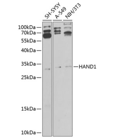 HAND1 Rabbit Polyclonal Antibody